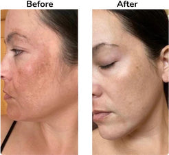 Hypochlorous Acid Spray